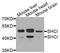 SHC-transforming protein 1 antibody, orb373718, Biorbyt, Western Blot image 