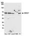 CWC27 Spliceosome Associated Cyclophilin antibody, A305-685A-M, Bethyl Labs, Western Blot image 