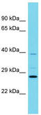 RAB, Member RAS Oncogene Family Like 6 antibody, TA330689, Origene, Western Blot image 