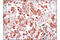 Fibroblast Growth Factor Receptor 1 antibody, 9740S, Cell Signaling Technology, Immunohistochemistry paraffin image 
