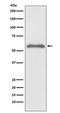 SMAD2 antibody, P00090, Boster Biological Technology, Western Blot image 