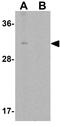 NK3 Homeobox 2 antibody, GTX17098, GeneTex, Western Blot image 