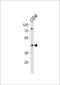 Fatty acid desaturase 2 antibody, PA5-25285, Invitrogen Antibodies, Western Blot image 