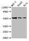 Glucosylceramidase Beta antibody, CSB-PA009289LA01HU, Cusabio, Western Blot image 