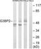 G3BP Stress Granule Assembly Factor 2 antibody, TA314986, Origene, Western Blot image 