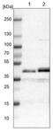 Lipoic Acid Synthetase antibody, NBP1-82845, Novus Biologicals, Western Blot image 