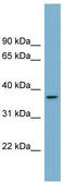 Olfactory Receptor Family 2 Subfamily W Member 5 (Gene/Pseudogene) antibody, TA336177, Origene, Western Blot image 