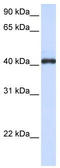 Fc Receptor Like A antibody, TA339624, Origene, Western Blot image 