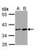 Galanin Receptor 3 antibody, PA5-28747, Invitrogen Antibodies, Western Blot image 