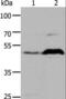5-Hydroxytryptamine Receptor 1A antibody, LS-B16487, Lifespan Biosciences, Western Blot image 