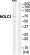 Nucleolar And Coiled-Body Phosphoprotein 1 antibody, TA314879, Origene, Western Blot image 