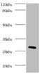 CA1 antibody, A53734-100, Epigentek, Western Blot image 