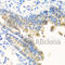 Nyctalopin antibody, A7830, ABclonal Technology, Immunohistochemistry paraffin image 