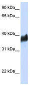 CLN8 Transmembrane ER And ERGIC Protein antibody, TA331069, Origene, Western Blot image 