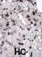 Hexokinase-2 antibody, abx033901, Abbexa, Immunohistochemistry frozen image 