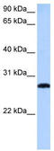 Max-like protein X antibody, TA339232, Origene, Western Blot image 