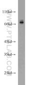 Cell Division Cycle 25B antibody, 10644-1-AP, Proteintech Group, Western Blot image 