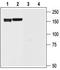 Potassium Voltage-Gated Channel Subfamily H Member 6 antibody, TA328662, Origene, Western Blot image 