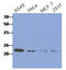 Chitinase 3 Like 1 antibody, AM50351PU-S, Origene, Western Blot image 