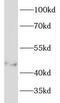 Keratin 33B antibody, FNab04652, FineTest, Western Blot image 