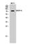 A-Kinase Anchoring Protein 8 antibody, STJ91533, St John