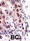 Ubiquitin Conjugating Enzyme E2 S antibody, abx031529, Abbexa, Immunohistochemistry paraffin image 