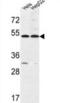 Fermitin family homolog 1 antibody, abx034155, Abbexa, Western Blot image 