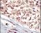 Ephrin type-A receptor 5 antibody, PA5-14581, Invitrogen Antibodies, Immunohistochemistry paraffin image 