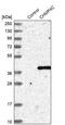 Charged Multivesicular Body Protein 4C antibody, PA5-54889, Invitrogen Antibodies, Western Blot image 