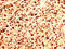 Platelet Factor 4 antibody, LS-C670940, Lifespan Biosciences, Immunohistochemistry paraffin image 
