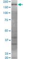 WRN RecQ Like Helicase antibody, H00007486-M06, Novus Biologicals, Western Blot image 