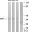 CDK-activating kinase assembly factor MAT1 antibody, TA314210, Origene, Western Blot image 