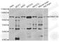 DNA Methyltransferase 3 Beta antibody, A7239, ABclonal Technology, Western Blot image 