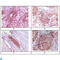 RAB25, Member RAS Oncogene Family antibody, LS-C814070, Lifespan Biosciences, Immunohistochemistry paraffin image 