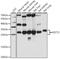 Glutathione S-Transferase Theta 2 (Gene/Pseudogene) antibody, A09339, Boster Biological Technology, Western Blot image 