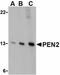 Presenilin Enhancer, Gamma-Secretase Subunit antibody, orb74775, Biorbyt, Western Blot image 
