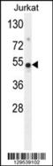 Family With Sequence Similarity 118 Member B antibody, 55-948, ProSci, Western Blot image 