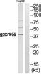 Single Stranded DNA Binding Protein 2 antibody, TA315266, Origene, Western Blot image 