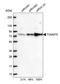 Translocase Of Outer Mitochondrial Membrane 70 antibody, HPA048020, Atlas Antibodies, Western Blot image 