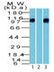 CTNNB1 antibody, AP32836PU-S, Origene, Western Blot image 