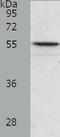 Angiopoietin Like 2 antibody, TA321810, Origene, Western Blot image 