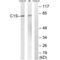 Complement C1s antibody, A02057, Boster Biological Technology, Western Blot image 