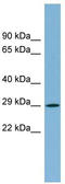 Myelin Protein Zero Like 2 antibody, TA339027, Origene, Western Blot image 