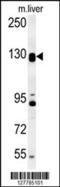 DENN Domain Containing 5B antibody, 55-123, ProSci, Western Blot image 