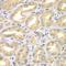 Engulfment And Cell Motility 3 antibody, GTX55603, GeneTex, Immunohistochemistry paraffin image 