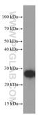 Guanidinoacetate N-Methyltransferase antibody, 66322-1-Ig, Proteintech Group, Western Blot image 