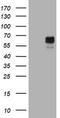 Tyrosinase antibody, TA801362BM, Origene, Western Blot image 