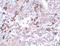Breast Carcinoma Amplified Sequence 1 antibody, A13589, Boster Biological Technology, Immunohistochemistry paraffin image 