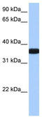 Occludin/ELL Domain Containing 1 antibody, TA339756, Origene, Western Blot image 
