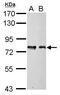 MAGUK p55 subfamily member 5 antibody, PA5-28109, Invitrogen Antibodies, Western Blot image 